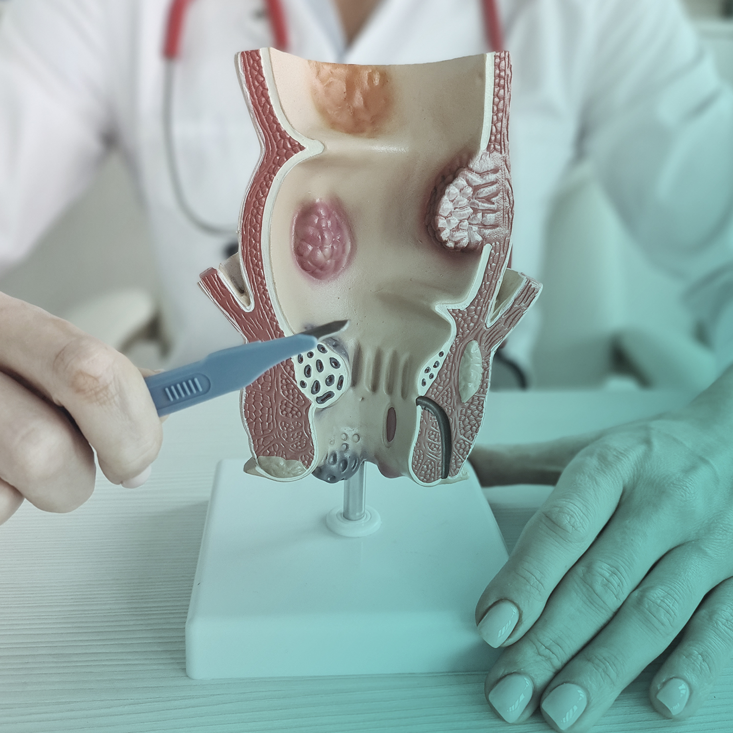 PROCTOLOGIA al J|medical