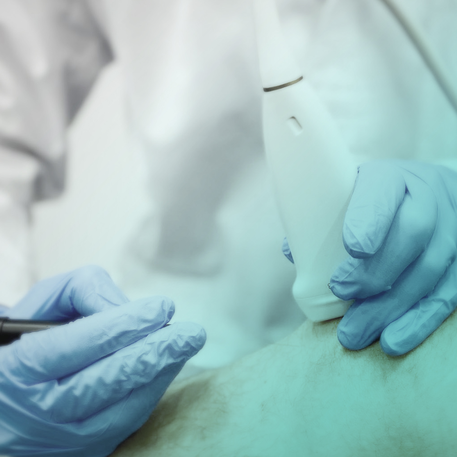 ELETTROLISI PRECUTANEA ECOGUIDATA e NEUROMODULAZIONE al J|medical